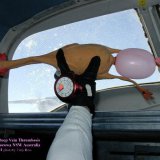 deep_vein_thrombosis